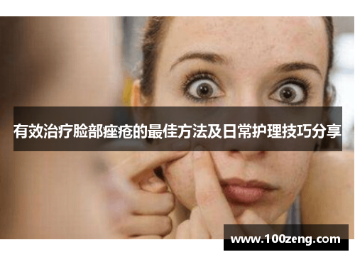 有效治疗脸部痤疮的最佳方法及日常护理技巧分享